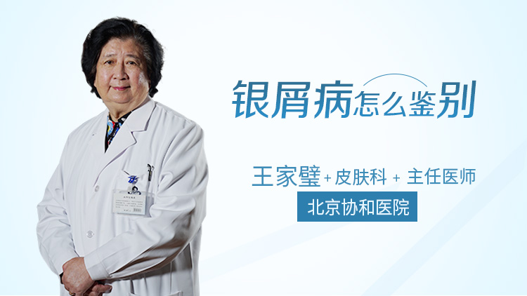 银屑病怎么鉴别