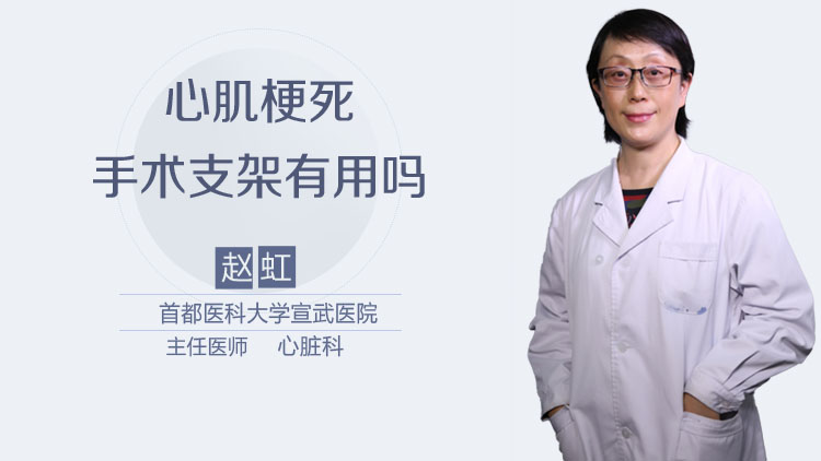 心肌梗死手术支架有用吗