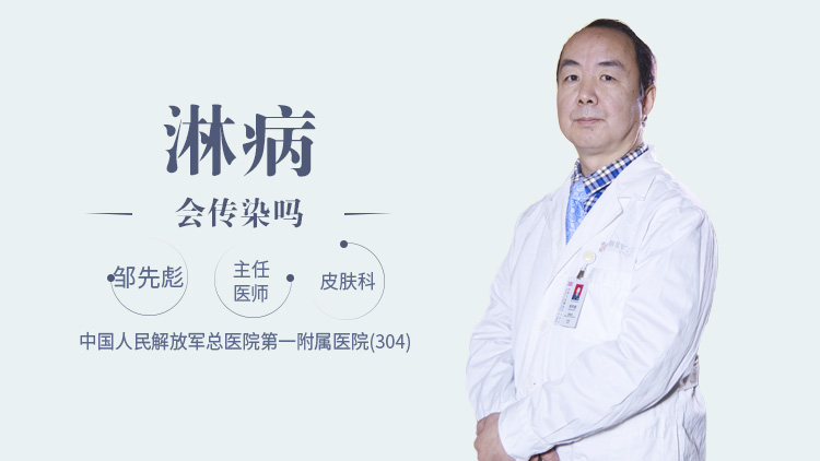 淋病会传染吗