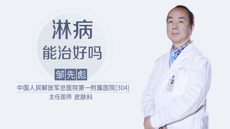 淋病能治好吗