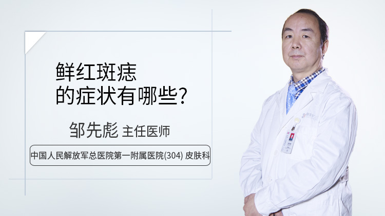 鲜红斑痣的症状有哪些