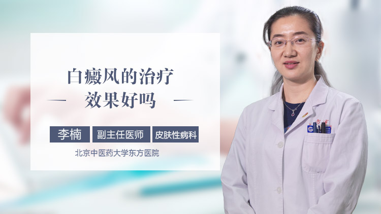 白癜风的治疗效果好吗