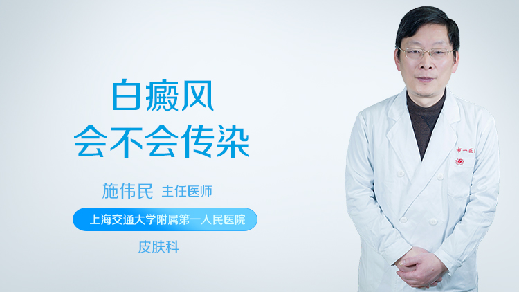 白癜风会不会传染