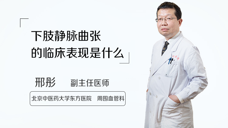 下肢静脉曲张的临床表现是什么