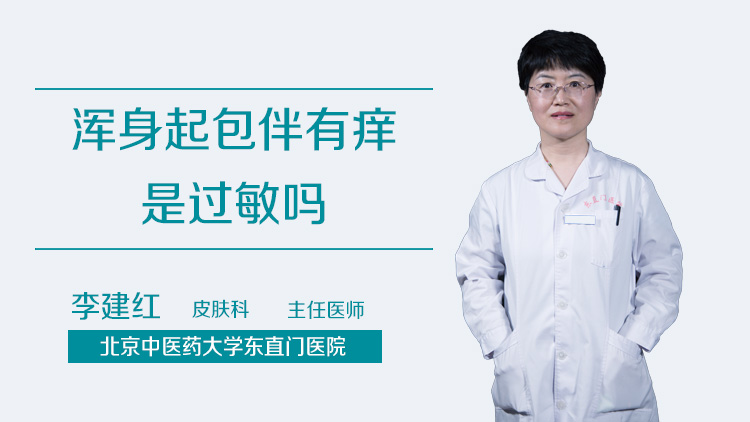 浑身起包伴有痒是过敏吗