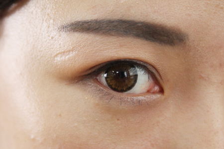 红眼病的潜伏期一般在24小时以内 红眼病的潜伏期一般在24小时以内