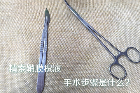 精索鞘膜积液手术步骤是什么