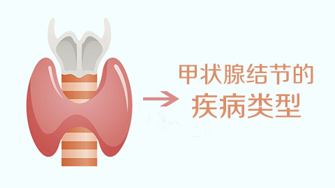 甲状腺结节的疾病类型
