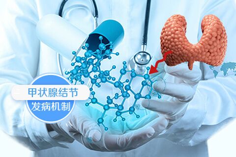 甲状腺结节的发病机制