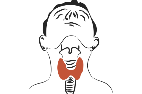 甲状腺结节复发的原因有什么