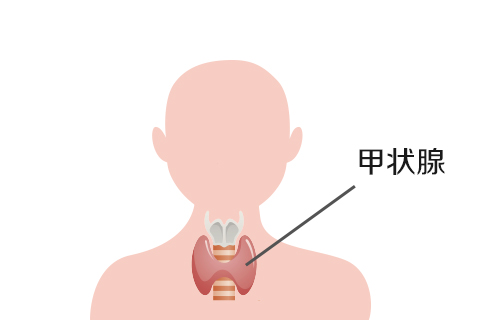 中医认为甲状腺结节是由于气血淤积、正气虚弱导致脏腑功能失调引起的。