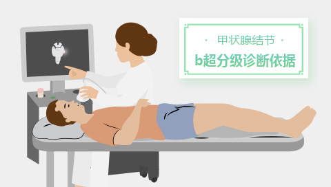 甲状腺结节b超分级诊断依据