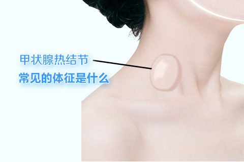 甲状腺热结节常见的体征是什么
