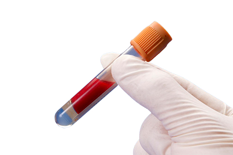 甲状腺结节诊断标准可以通过血清学的检查或者b超检查来进行判断