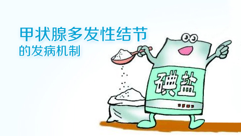 甲状腺多发性结节的发病机制