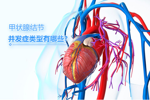甲状腺结节并发症类型有哪些