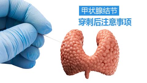 甲状腺结节穿刺后注意事项
