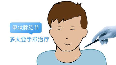 甲状腺结节多大要手术治疗