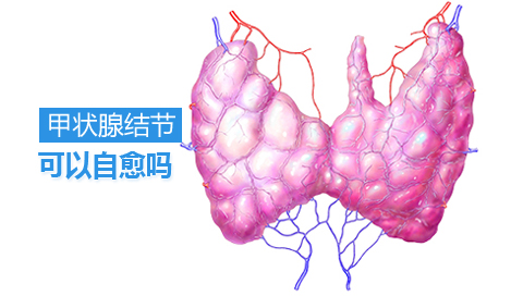 甲状腺结节可以自愈吗