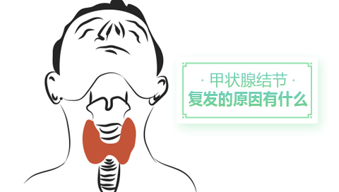 甲状腺结节复发的原因有什么