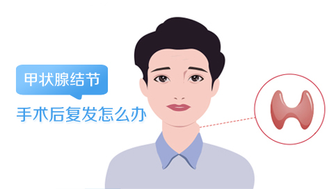 甲状腺结节手术后复发怎么办