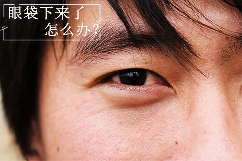 眼袋下来了怎么办