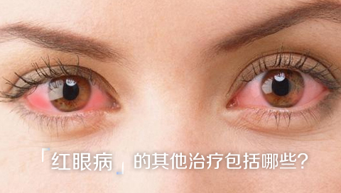 红眼病的其他治疗包括哪些