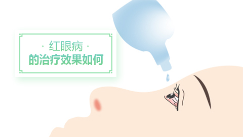红眼病的治疗效果如何