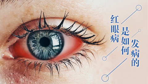 红眼病是如何发病的