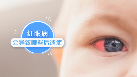 红眼病会导致哪些后遗症