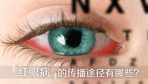 红眼病的传播途径有哪些
