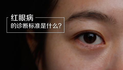 红眼病的诊断标准是什么