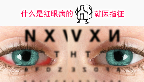 什么是红眼病的就医指征