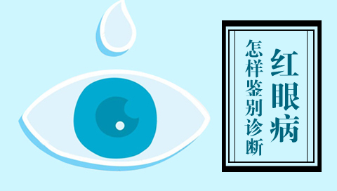 怎样鉴别诊断红眼病