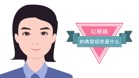 红眼病的典型症状是什么