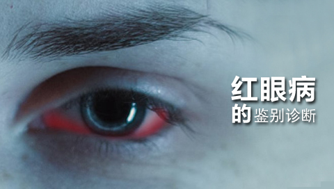 红眼病的鉴别诊断