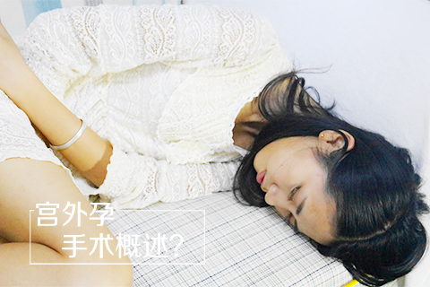 宫外孕手术概述