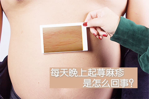 每天晚上起荨麻疹是怎么回事