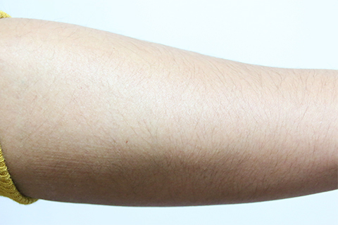 汗毛是生长在人体皮肤表面的毛发