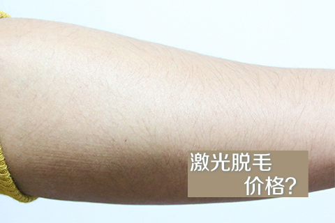 激光脱毛价格