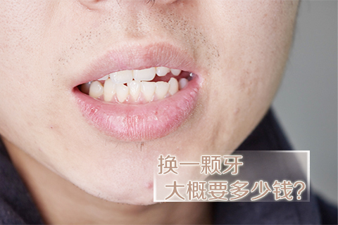 换一颗牙大概要多少钱