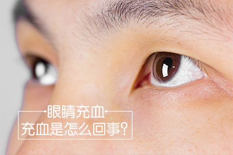眼睛充血是怎么回事