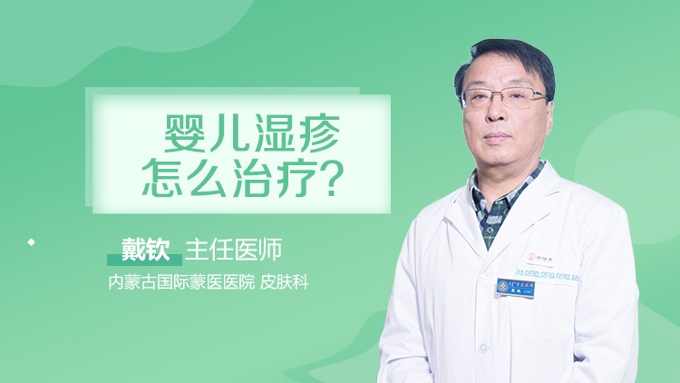 婴儿湿疹怎么治疗