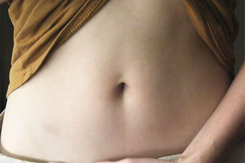 引起肚脐眼周围疼的原因有很多