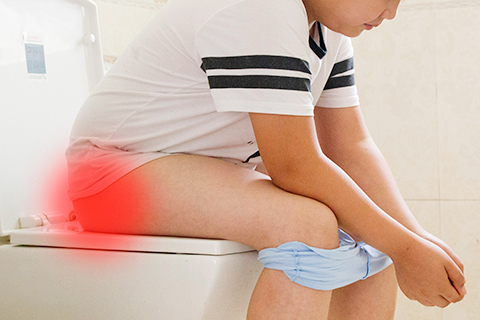 痔疮分内痔、外痔。内痔和外痔同时存在称为混合痔。