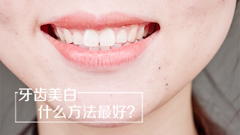 牙齿美白什么方法最好
