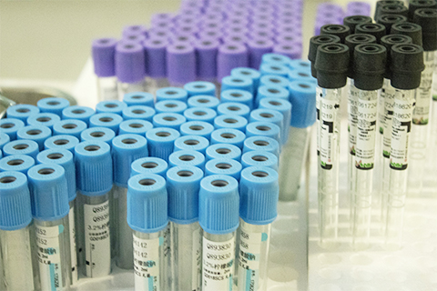 嗜酸性粒细胞是人体中白细胞的组成部分之一