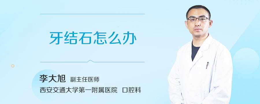 牙结石怎么办