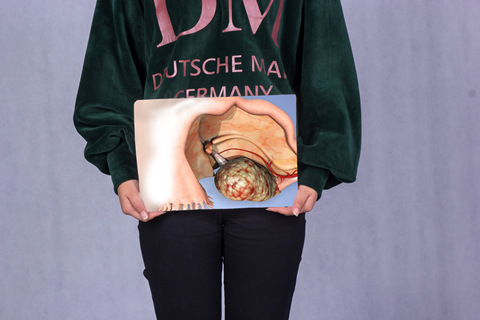 目前可以引起多囊卵巢的因素可以分为遗传性以及非遗传性