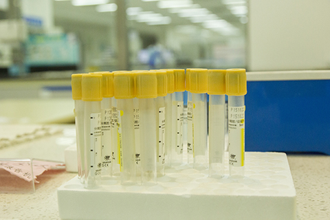 HCG就是人绒毛膜促性腺激素,这是一种由胎盘滋养层细胞分泌的糖蛋白激素。孕酮就是黄体酮,也称为黄体激素 HCG就是人绒毛膜促性腺激素,这是一种由胎盘滋养层细胞分泌的糖蛋白激素。孕酮就是黄体酮,也称为黄体激素